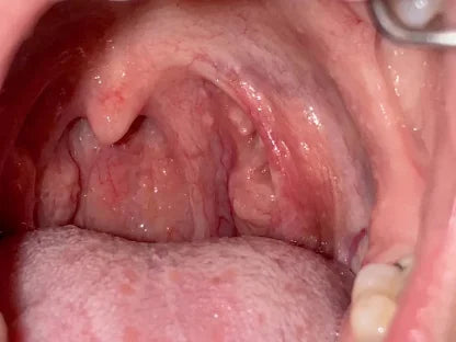 After 8 weeks